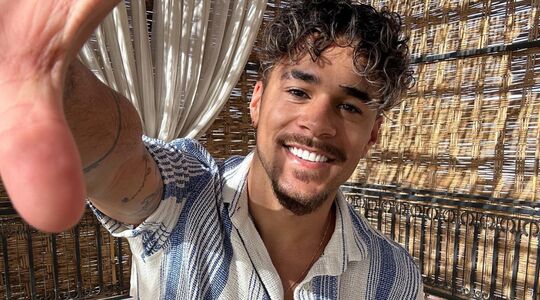 mattheus-love-island-haartransplantatie
