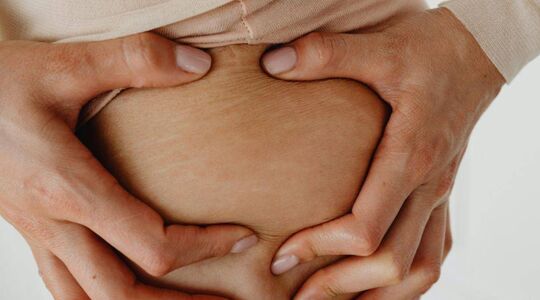 3 producten die helpen tegen striae en stretchmarks