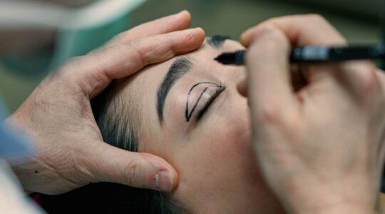 Vrouw krijgt ooglidcorrectie.