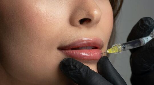 Vrouw krijgt lipfillers.