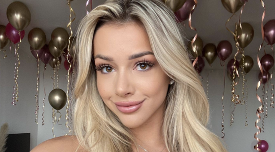 Zo zag Emma Heesters eruit voor haar fillers en botox