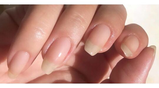 eten voor sterke nagels