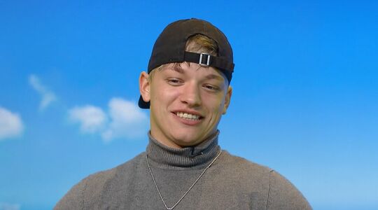 EOTB's Dusty ontvangt bakken kritiek na haartransplantatie