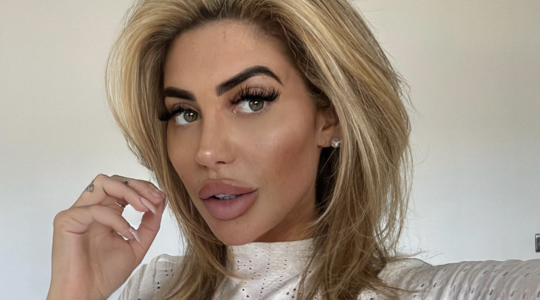 Chloé Ferry cosmetische ingreep