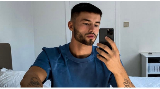 Love Island Lennert haartransplantatie