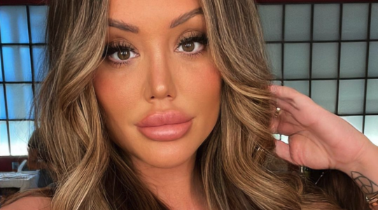 Geordie Shore Charlotte Crosby fillers lippen