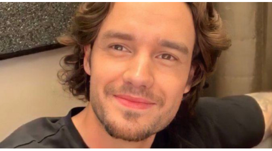 Liam Payne cosmetische ingrepen one direction