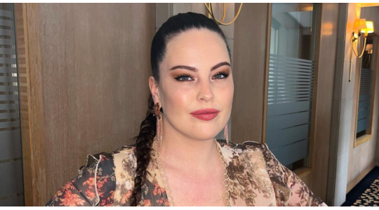 Robin Martins botox reactie Instagram