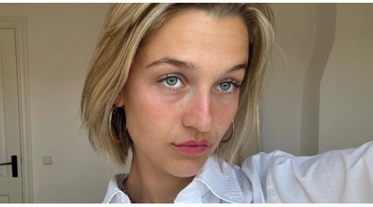 Lip combinatie natural lipfillers Lisa Korver