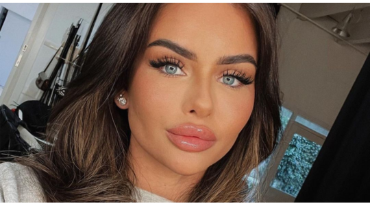 Sarah van Soelen afscheid lipfillers plastische chirurgie