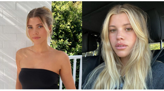 scandi Scandinavische hairline haarlijn trend tiktok sophia richie