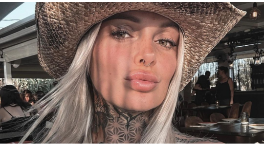 Pommeline Tillière lipfillers