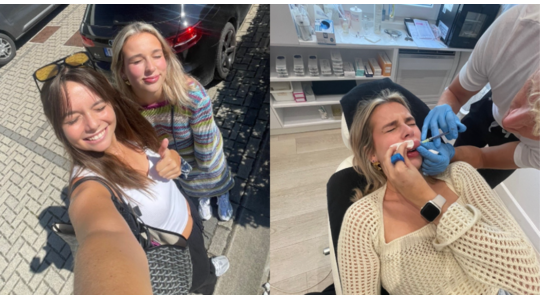 allergische reactie lipfillers tiktok