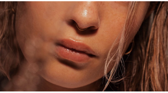 lip filler botox