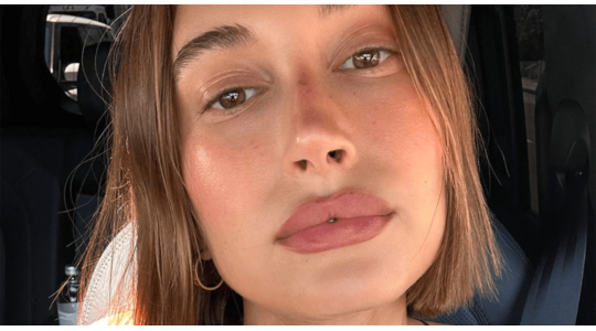 lipfillers