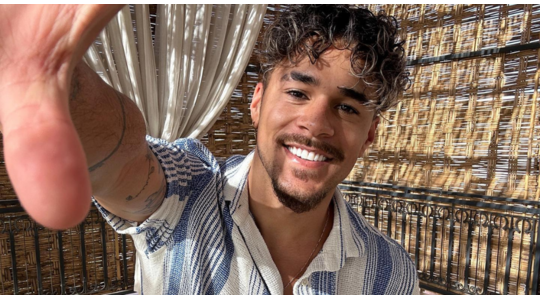 mattheus-love-island-haartransplantatie