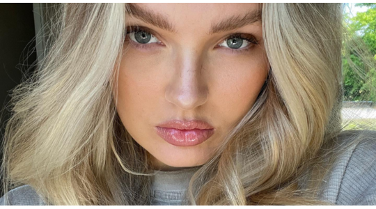 vollere lippen romee strijd