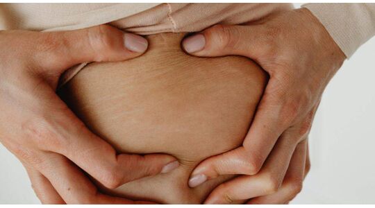 3 producten die helpen tegen striae en stretchmarks